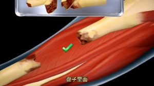 骨折手术模拟器官方版图3