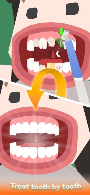 空闲的牙医中文版图1