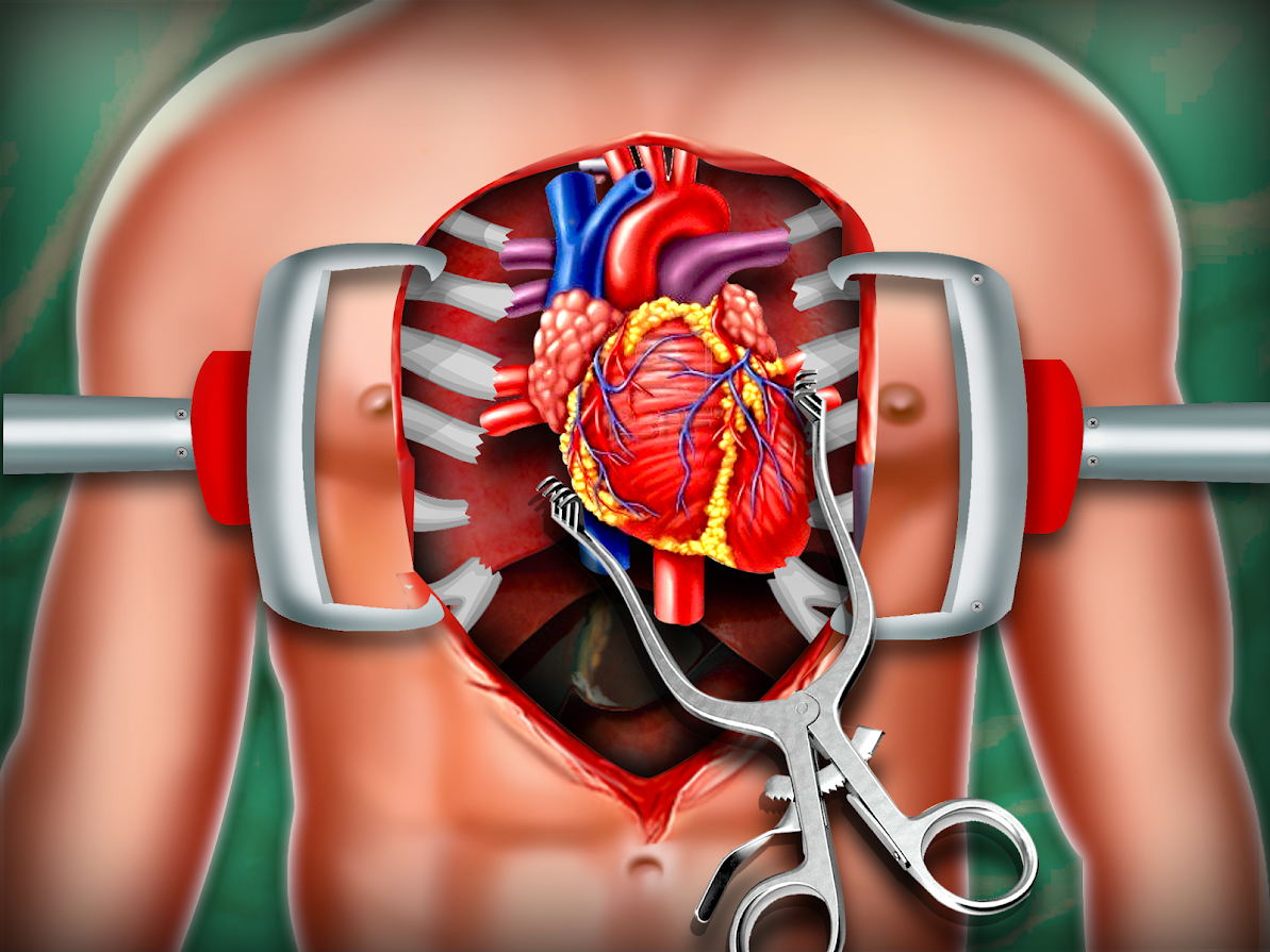 模拟心脏手术游戏图3: