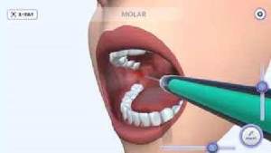 牙医模拟手机版图2