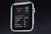 Apple Watch第二代的规格以及功能等曝光[多图]